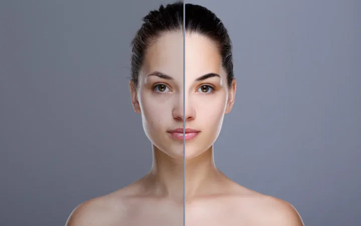 Split image of a woman with tied-back hair, showing contrasting skin tones; left side is natural, right side is lighter, illustrating complexion change.