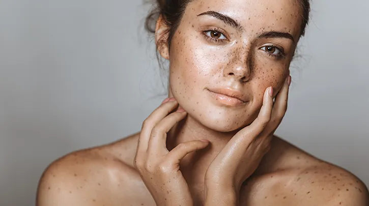 A woman with freckles gazes softly at the camera, one hand resting on her cheek. Her expression is serene, highlighting natural beauty.